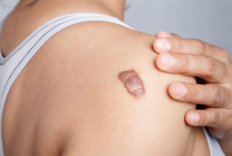 دکتر کلوئید در مشهد